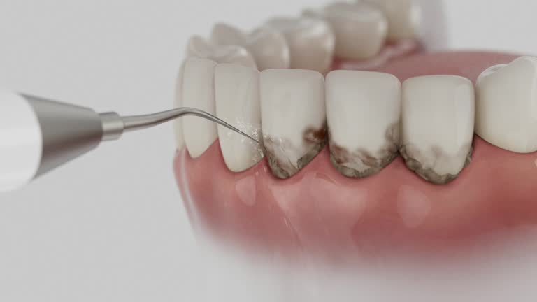 Trusted Tooth Extraction service in Lawton, OK - Dentist Open Now